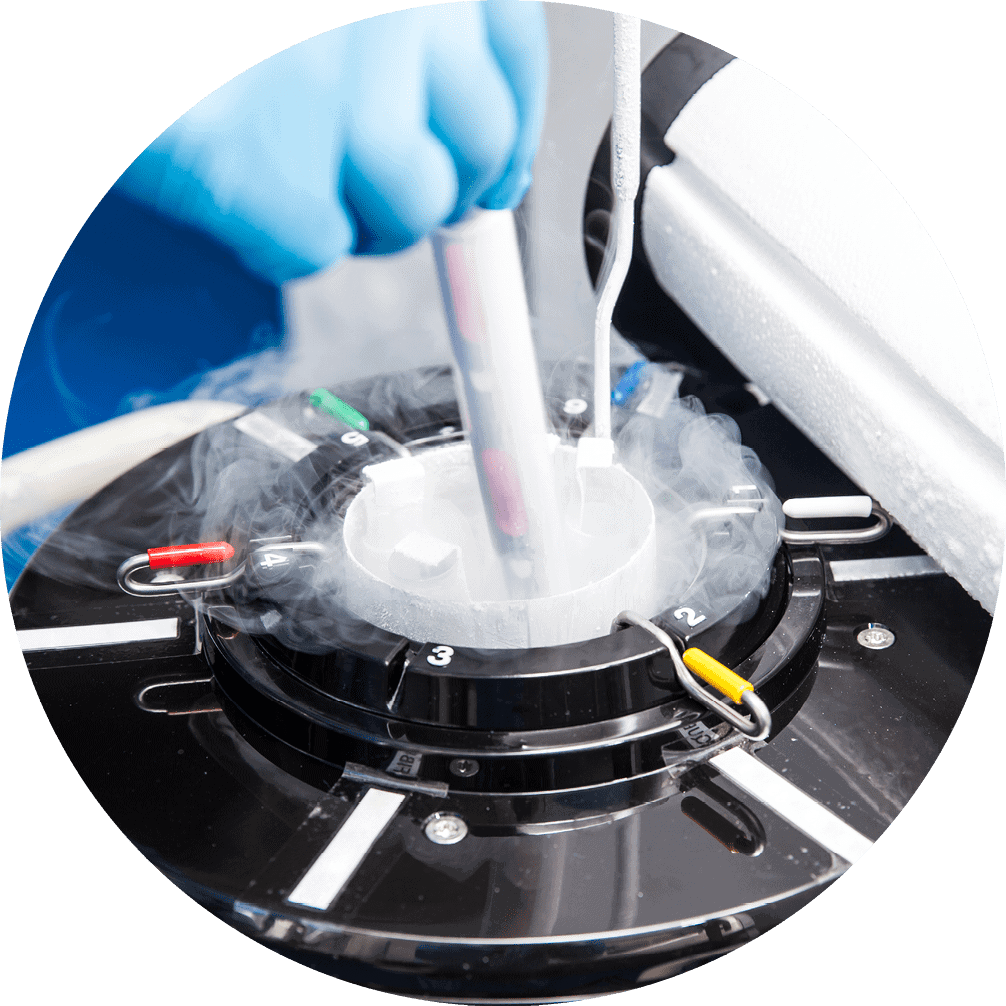Close-up of a blue-gloved hand holding a device to freeze donor eggs in a medical lab.